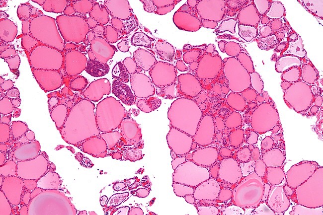 File:Thyroid cells.jpg