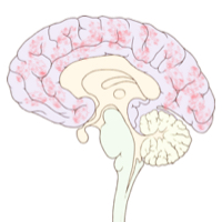 File:Brain Small Richardson Brain Autopsy.jpg