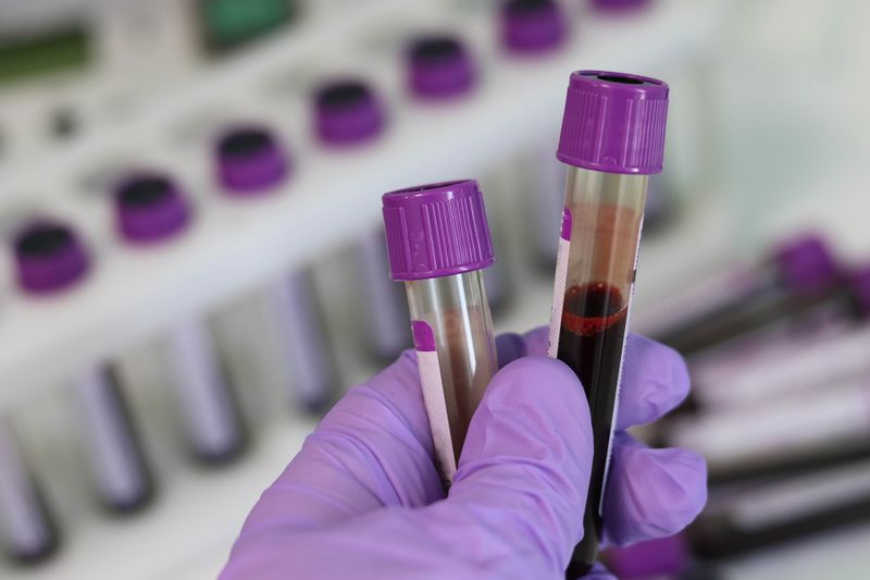 File:Blood-test-tubes.jpg