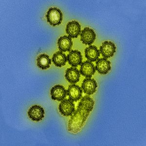 H1N1 virus particles.jpg