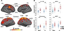 Fig. 2. Fibromyalgia Glial Activation Voxelwise group differences in [11C]PBR28 SUVR A