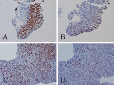 File:Enterovirus VP1 & dsRNA in stomach, Chia 2015. 400px.png