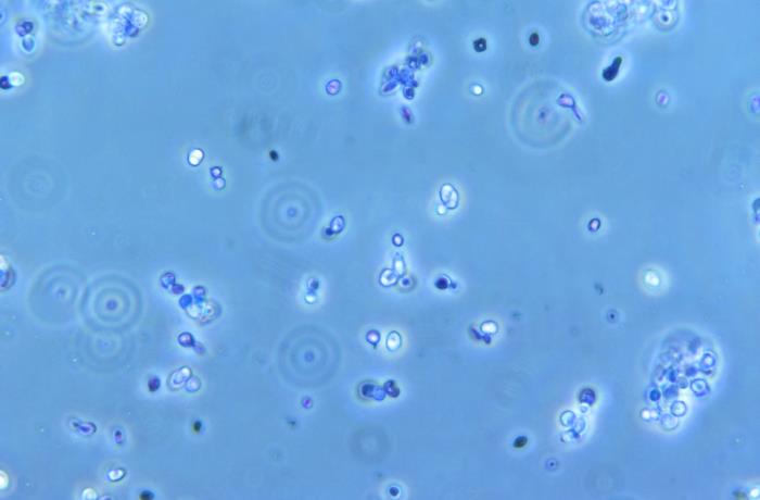 File:Brewers yeast structure.jpg