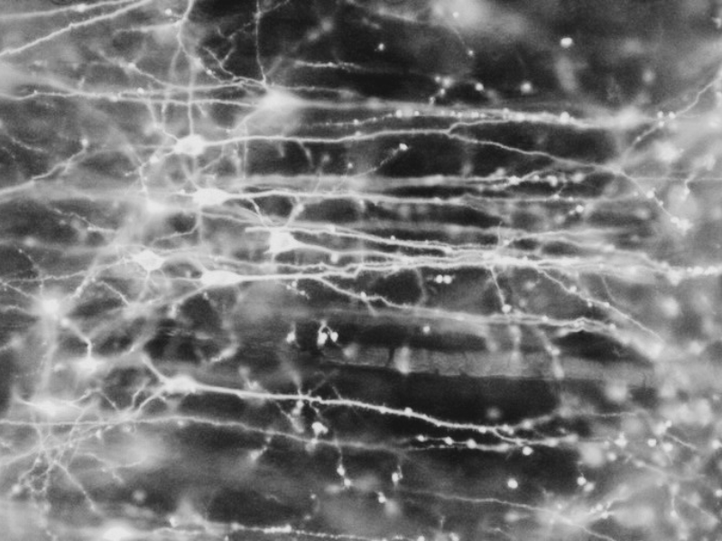 Attribution: Neurons in the brain by Dr Jonathan Clarke - Wellcome Collection, United Kingdom - CC BY. https://www.europeana.eu/item/9200579/udqg385v