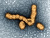 H1N1 virus particles II.jpg