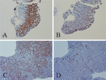 Enterovirus VP1 and dsRNA in stomach. John Chia 2015 paper.png