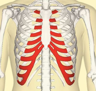 Costochondritis - MEpedia