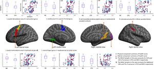 Brain function characteristics of chronic fatigue syndrome A task fMRI study (2018).jpeg