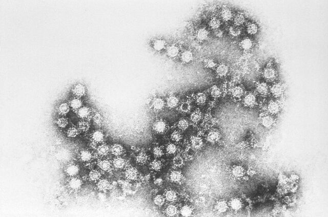 Coxsackie B Virus - MEpedia