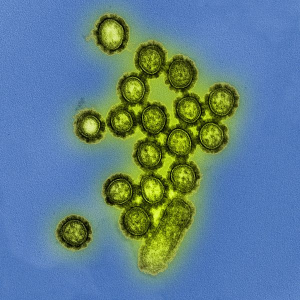 File:H1N1 virus particles.jpg